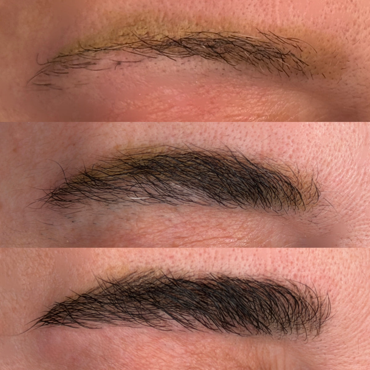 Eyebrow Renewal